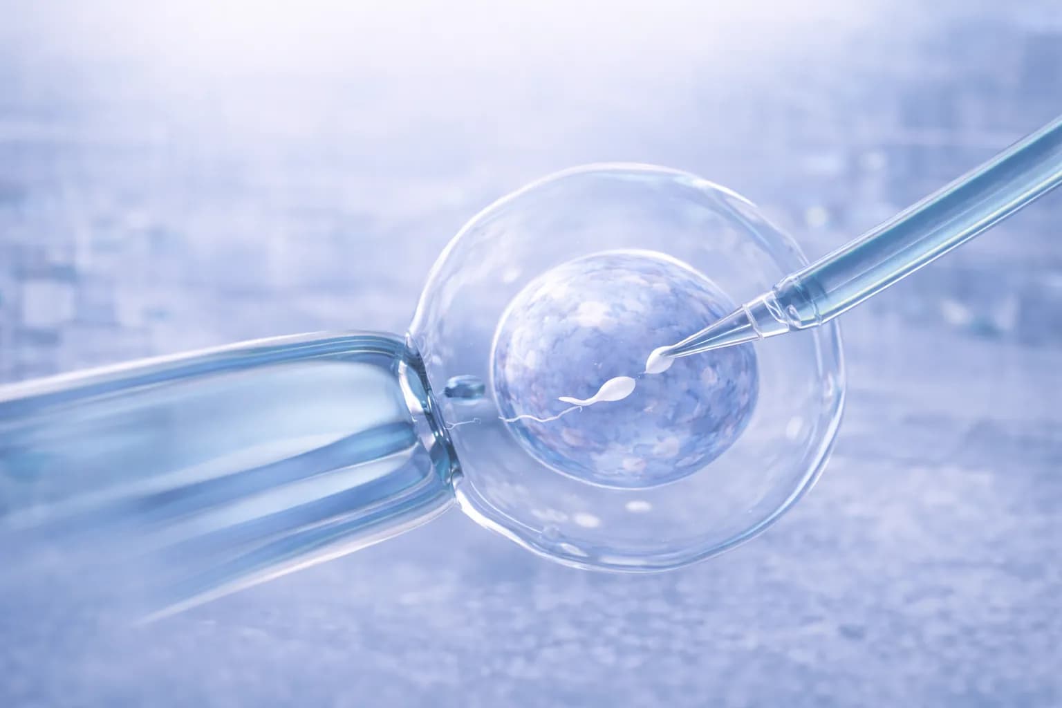 In Vitro Fertilization (IVF)